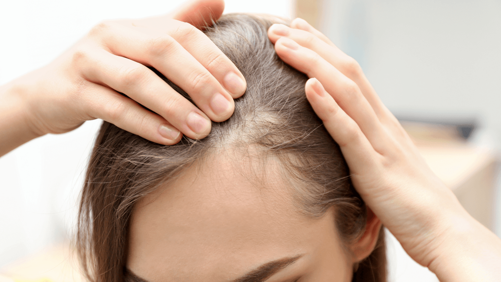 Salon Hair Loss A